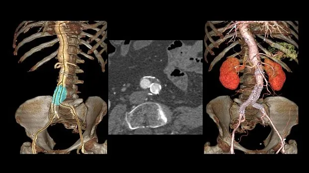 Клинические изображения GE Optima CT520 компьютерный томограф