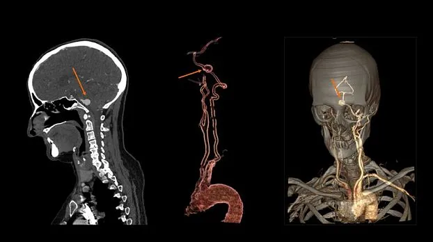 Клинические изображения GE Optima CT520 компьютерный томограф