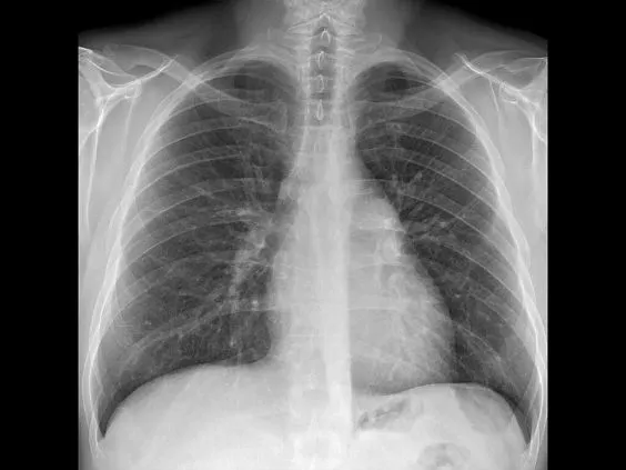 Клинические изображения GE Healthcare Optima XR220amx палатный цифровой рентгеновский аппарат