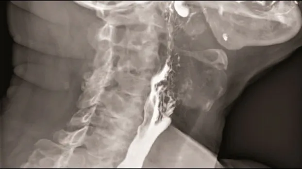 Клинические изображения Цифровой рентгеноcкопический аппарат GE Discovery RF180