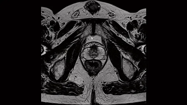 Клинические изображения МРТ аппарат Siemens Magnetom Sola 1,5T