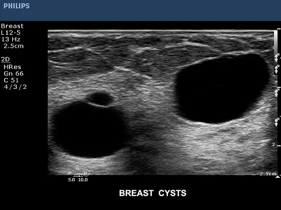 Клинические изображения Philips CX50 ультразвуковой аппарат