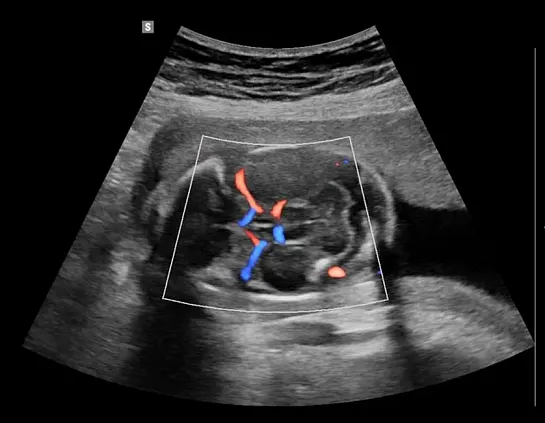 Клинические изображения УЗИ аппарат НПО СКАНЕР РУСКАН 65М