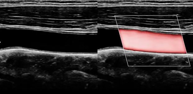 Клинические изображения УЗИ аппарат НПО СКАНЕР РУСКАН 65