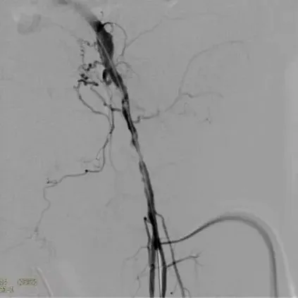 Клинические изображения Philips Zenition 70 C-дуга