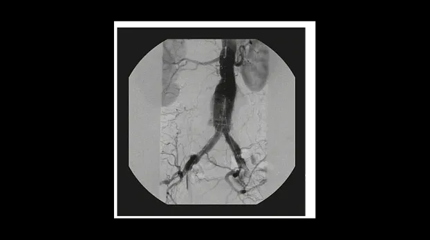 Клинические изображения Рентгенохирургический аппарат типа С-дуга GE OEC Elite CFD