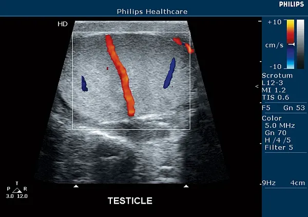 Клинические изображения Philips HD5 ультразвуковой аппарат