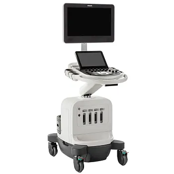 Philips Affiniti 50 ультразвуковой аппарат