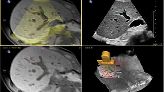 Клинические изображения Philips EPIQ Elite ультразвуковой аппарат