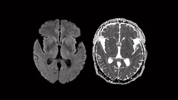 Клинические изображения МРТ аппарат Siemens Magnetom Sola 1,5T