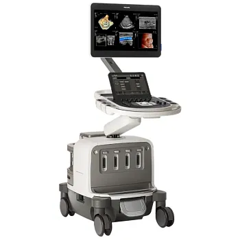 Philips EPIQ Elite ультразвуковой аппарат