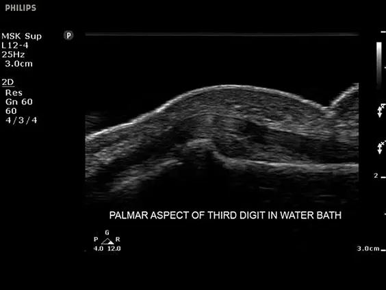 Клинические изображения Philips Sparq ультразвуковой аппарат