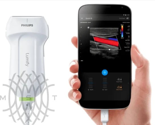 Philips Lumify ультразвуковой аппарат