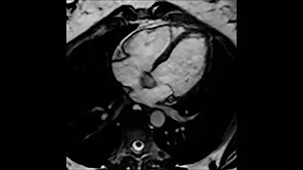 Клинические изображения МРТ аппарат Siemens Magnetom Sola 1,5T