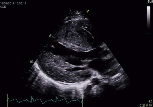 Клинические изображения Ультразвуковая диагностическая система GE HealthCare Vivid E95