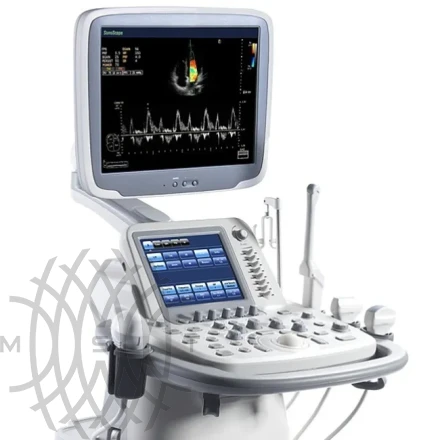 Sonoscape S15 ультразвуковой аппарат