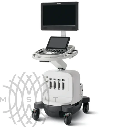 Philips Affiniti 30 ультразвуковой аппарат