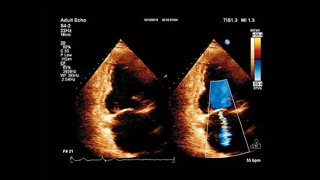 Клинические изображения Philips Affiniti 30 ультразвуковой аппарат