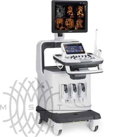 Samsung Medison Accuvix XG УЗИ аппарат
