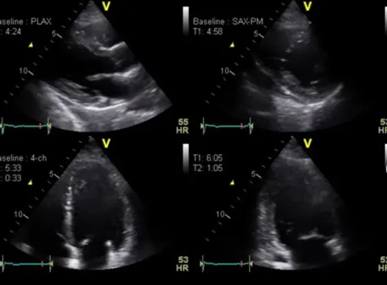 Клинические изображения GE HealthCare Vivid T9 аппарат ультразвуковой