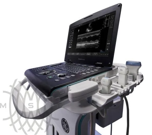 УЗИ аппарат GE Healthcare Versana Active портативный