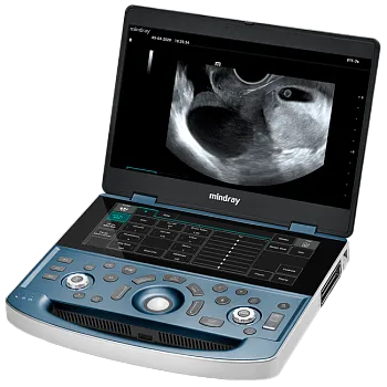 Портативный УЗИ аппарат Mindray MX8 Exp