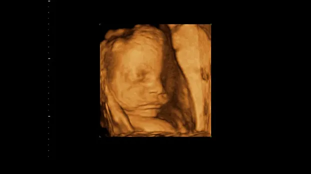 Клинические изображения GE HealthCare Versana Balance R2 УЗИ аппарат